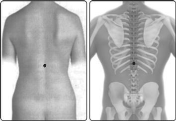 வர்மம்’ எனும் மர்மக்கலை!