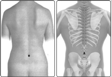 வர்மம்’எனும் மர்மக்கலை!