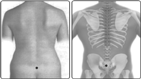 வர்மம்’எனும் மர்மக்கலை!