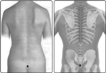வர்மம்’எனும் மர்மக்கலை!