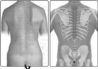 வர்மம்’ எனும் மர்மக்கலை!