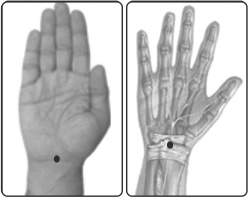 வர்மம் எனும் மர்மக்கலை!