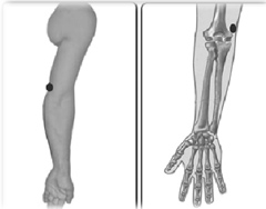 வர்மம் எனும் மர்மக்கலை!